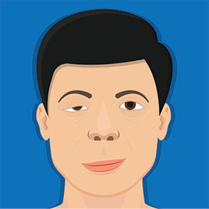 Illustration of a Man With a Droopy Eyelid Needing Reconstructive Surgery